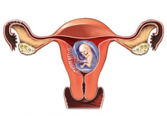 宫外孕的早期症状是什么？如何预防宫外孕？